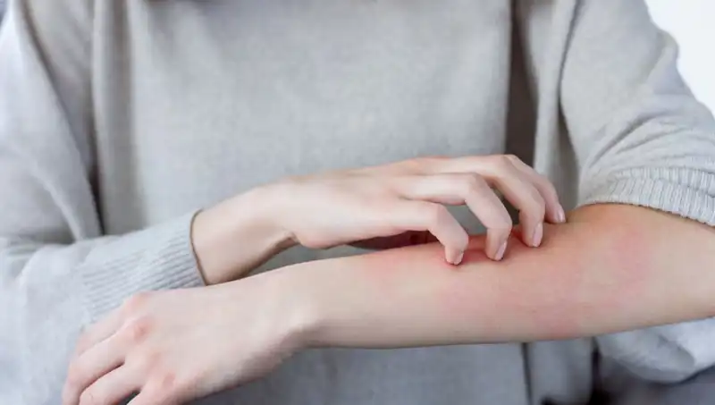 Cilt Kanserinin Gizli Belirtileri: Dermatologdan İpuçları Kullanın