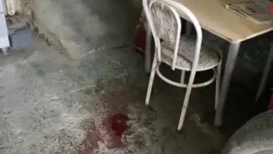 Sandalyeden Düşen Adamın Yaşadığı Korkunç Kaza