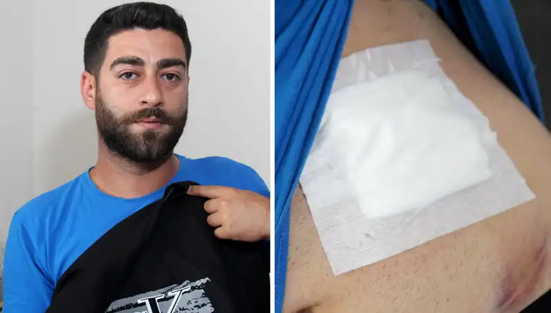Karnındaki Ağrının Nedeni Röntgende Şaşırtıcı Bir Şekilde Ortaya Çıktı